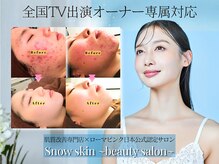 スノースキン(Snow skin)の雰囲気（本気で肌質改善を考えている方はぜひ専門店へお越しください。）