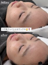 ラキ(LAKI)&nbsp;人気No.3 顔ワックス