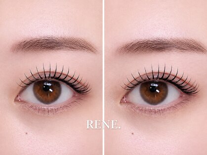 レネ(RENE.)の写真