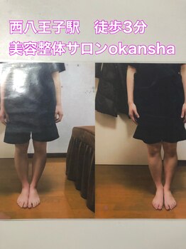美容整体サロン オオカンシャ(okansha)/O脚Before→after