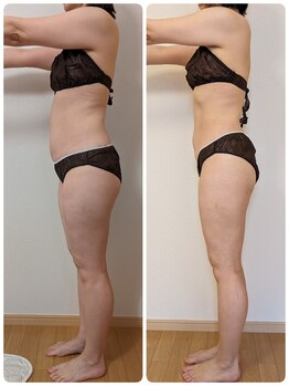 ヨサパーク アエル(YOSA PARK AELL)/よもぎ蒸し/痩身/整体/小顔/産後