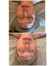 キラリ(Kirari)/陶肌トリートメントで美肌革命！