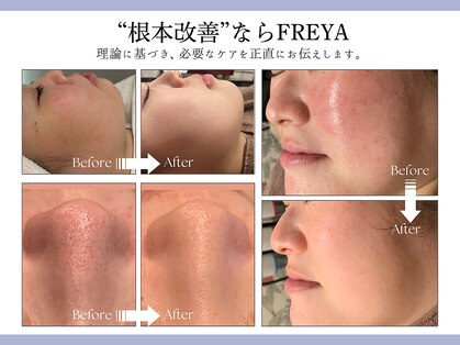 フレイヤ(FREYA)の写真