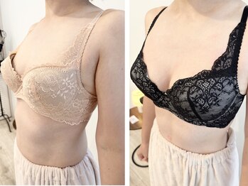 リソラ(risora)/バストアップ症例