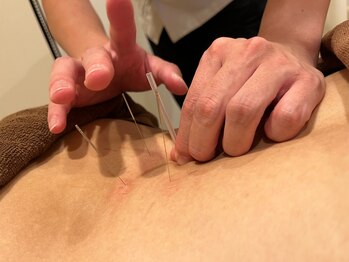 つつじが丘整骨院鍼灸マッサージ院/訪問鍼灸/マッサージ