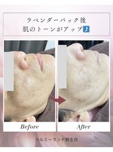 ベルミーランド MEGAドン・キホーテ桐生/パック後　Before→After