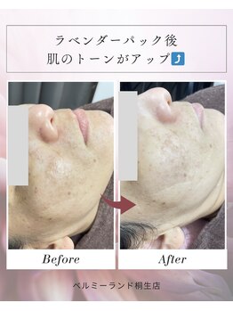 ベルミーランド MEGAドン・キホーテ桐生/パック後 Before→After
