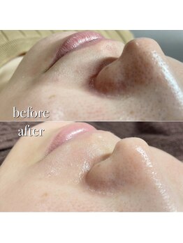 シリーラッシュ 自由が丘南口/フェイシャルワックス