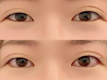 プレミアムガーデン(Premium Garden)/