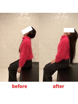 ナオル整体 福岡香椎院(NAORU整体)/30代女性施術事例【背中の凝り】