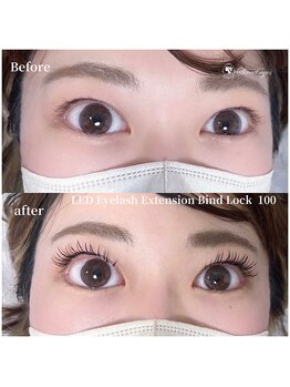 スウィートアイズ(Sweet eyes)/LEDバインドロック100束