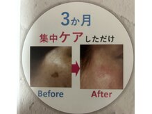 ヒカリ(HIKARI)の雰囲気（美容カイロエステ、日常スキンケア用品のご提案！美しい肌に変化）