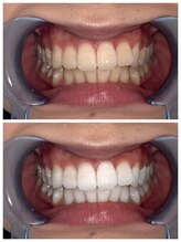 ライトビューティー 池袋店(LightBeauty)/症例写真