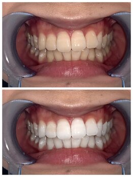 ライトビューティー 池袋店(LightBeauty)/症例写真