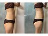 【痩身/ダイエット1パーツ】ピンポイントご希望の部位30分お得に体験！