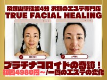 トゥルーフェイシャルヒーリング(TRUE FACIAL HEALING)