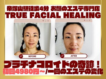 トゥルーフェイシャルヒーリング(TRUE FACIAL HEALING)の写真