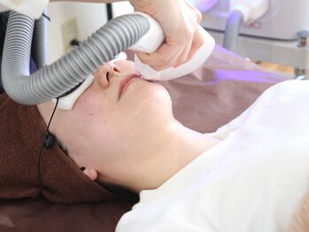 シーズ ザ デイ 熊本店(Seize the day)の写真/人気の美肌顔脱毛《初回3,000円!》毛穴が目立つのは毛が生えているからかも。脱毛しながらきれいな素肌に♪