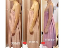 ロココ 豊田店(Rococo)の雰囲気（姿勢も骨格から変えていきます◎豊田バスト）