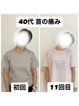ブレフィジ(BREFISI)の写真/【首・肩のつらさを根本改善】長年のコリや痛み、しびれまで…話題の技術で驚きの軽さをご体感ください★