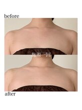 オン(On)/綺麗なバストライン♪
