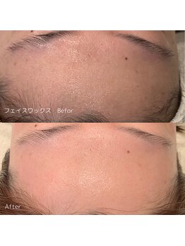 ハル(haru)/FWTフェイスワックス