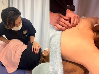 松戸駅前鍼灸院 整骨院の写真/身体や骨盤の歪みを整え悩み改善！産後にも◎平日限定骨盤矯正1000円～★疲労回復や代謝UPに！全身鍼2980円