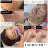 ブルーシー(BLUESEA)