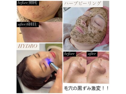 ブルーシー(BLUESEA)の写真
