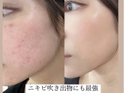 ミモアサロン 岡崎店(mimoaサロン)の写真