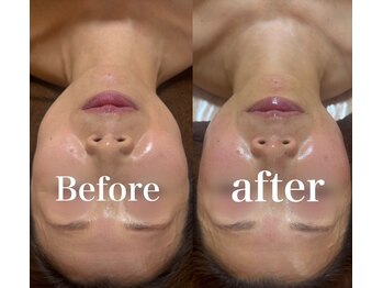 小顔 ツヤ肌/たるみの原因を整える小顔コルギ