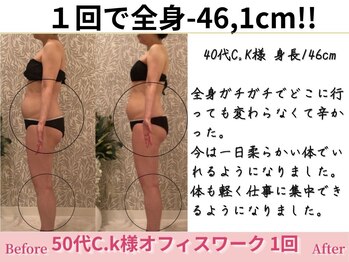 アメリイ 百合ヶ丘 新百合ヶ丘(Amerii)/【50代痩身】全身-46.1cm痩せ
