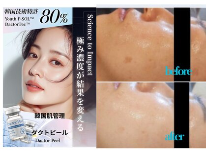 ラフィリス(RAFFILICE)の写真