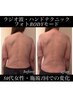 【夏限定】上半身集中40代からでも間に合う結果重視痩身コース