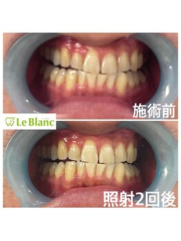 ルブラン 奈良店(Le Blanc)/美意識の高い男性のお客様