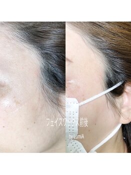 ネイル&アイラッシュ ルミア(Nail & Eyelash LUMIA)/～LumiA～ フォトギャラリー