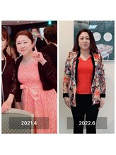 ヨサ パーク コアハート(YOSA PARK CORE HEART)/ー4キロ