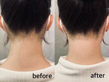 ネイルアンドアイラッシュ アヴィ(Nail and Eyelash A'vi)/ うなじ襟足　光×ワックス脱毛