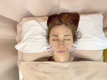 こじま 富雄団地接骨院/ヒト幹細胞美容鍼