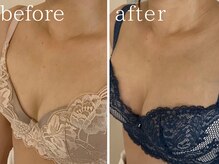 フォー(For...)/オーナー施術◇育乳バストUP♪