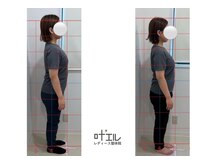 叶'エル 本町 心斎橋院/姿勢改善　骨盤矯正