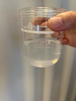 スターリィ スカイ(Starry☆Sky)/毛穴洗浄after