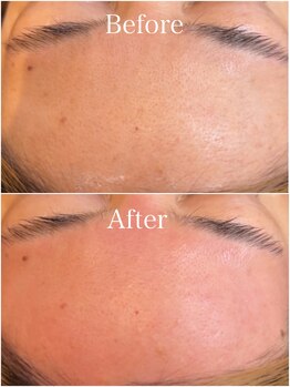 ジョエルワックス 沖縄那覇店(JOELLE WAX)/気になる部分脱毛！単品選択不可