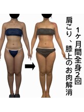 スピード美人 新宿店/スライドカッピング全身3回