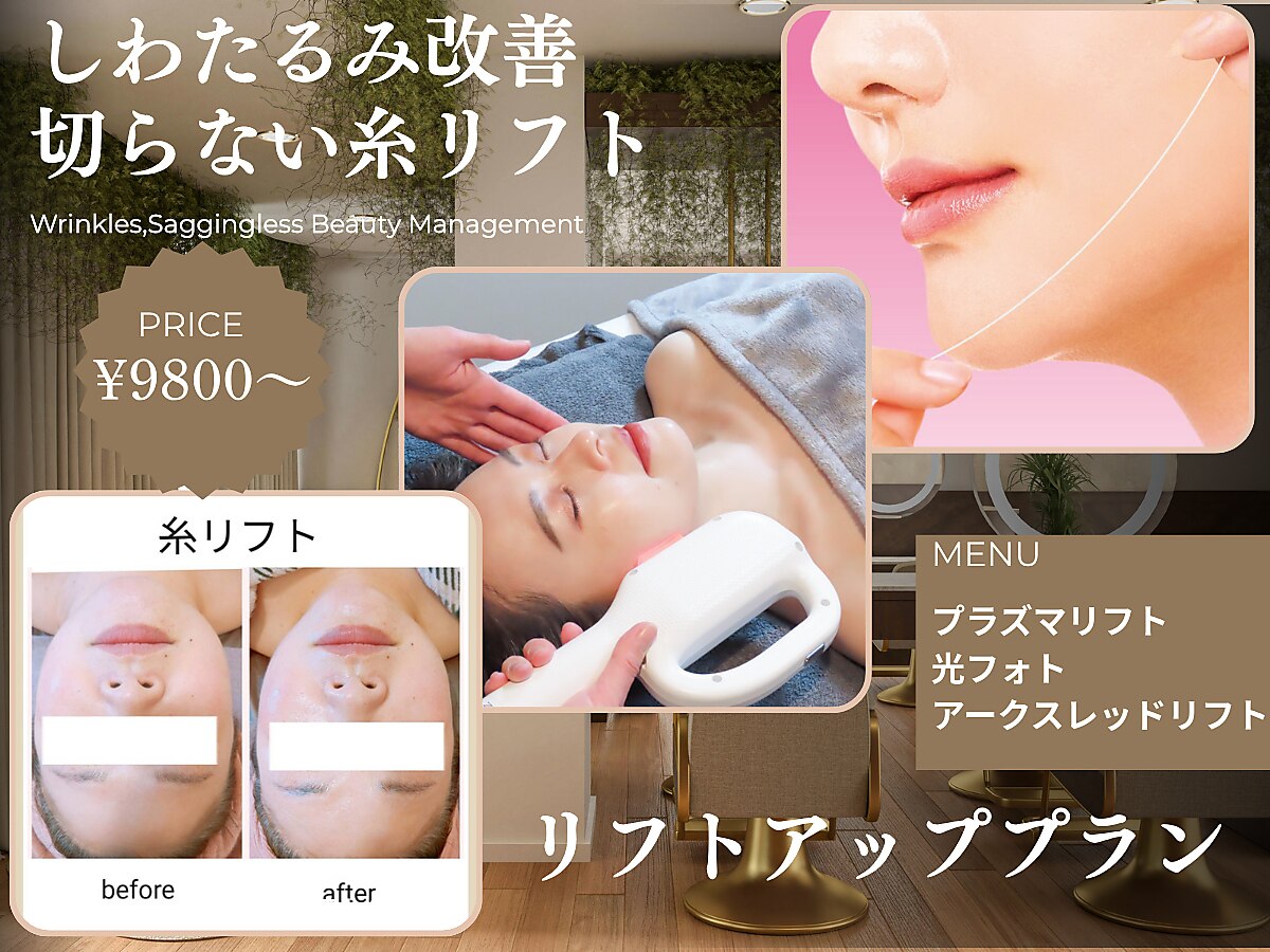 今だけ値下げ　美容機器　スポットケア 今だけ値下げ美容機器 スポットケア 【公式通販】