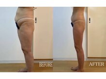 メルシー サロン(Merci Salon)の雰囲気（本格痩身！40代マイナス19キロ！痩せる自分に自信がつく♪）