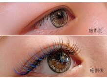 ドーズリュバンドール(DOUZE Ruban ｄ'or)/ラッシュシャドウ＊