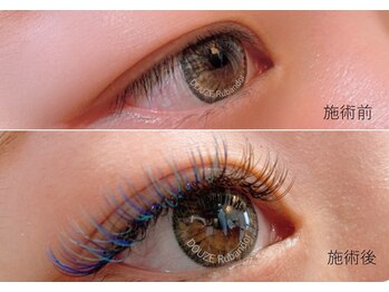 ドーズリュバンドール(DOUZE Ruban ｄ'or)/ラッシュシャドウ＊