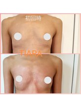 ティアラ(TIARA)/インスタ【@takara_tiara】