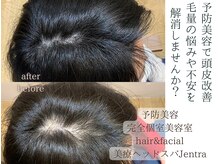 ジェントラ(Jentra)の雰囲気（30代からのフェイシャルエステ・ヘッドエステ／痩身にも◎頭浸浴）